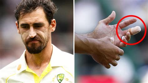 Mystery surrounds Mitchell Starc amid Boxing Day injury fears - Yahoo Sport