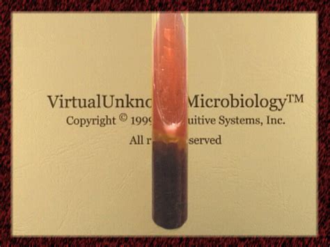 Hydrogen sulfide (H2S) production test - Virtual Microbiology Lab ...