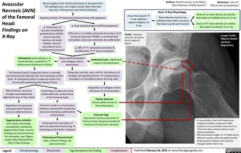 Avascular Necrosis (AVN) of the Femoral Head: Findings on X-Ray ...