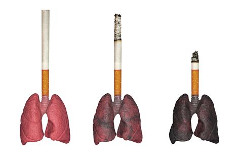 How to Help Lungs Recover After Quitting Smoking