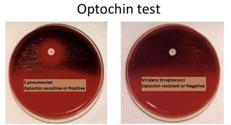 Optochin Test: Principle, Requirements, Procedure, Result ...