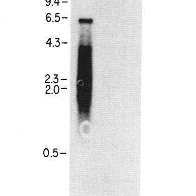 Northern Blot Analysis | Download Scientific Diagram