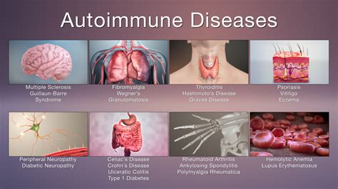 Autoimmune Diseases: Symptoms and Treatments - Scientific animations