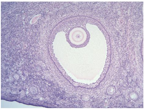 Ovary histology Diagram | Quizlet