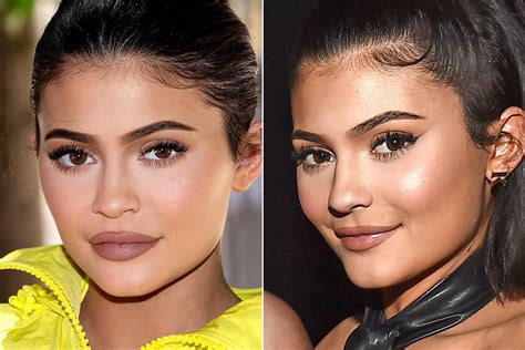 See Kylie Jenner's Filler-Free Lips in First Outing Since She Revealed ...