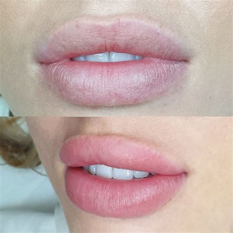 How To Get Pink Lips Permanently Treatment | Lipstutorial.org