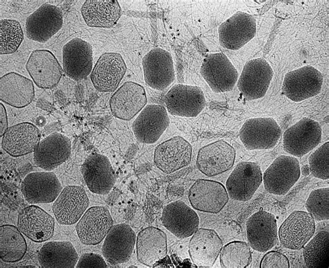 Bacteriophages | Taken with ZEISS Libra 120 TEM. Bacteriopha… | Flickr