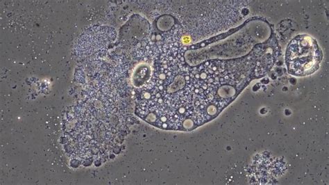 Germ vs Soap. What happens when we wash hands? (Microscope Footage ...