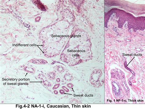 Block12/Fig. 4-2 Sebaceous glands and sweat glands.