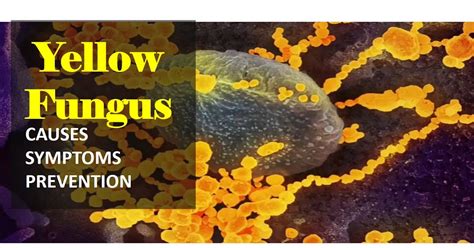 Yellow Fungus : Causes, Symptom and its prevention