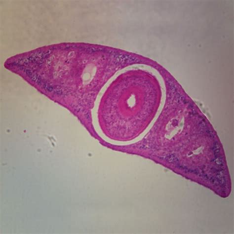 Planaria, c.s., General Structure 7 µm H&E Microscope Slide | Carolina.com