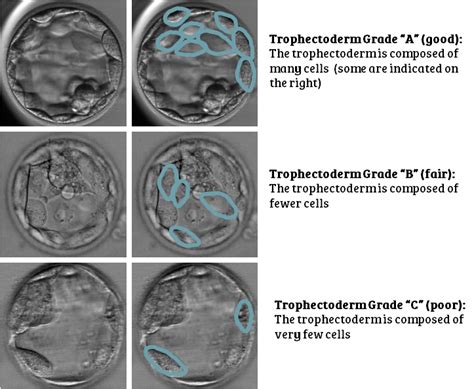 Embryo grading for Day 3 & Day 5 embryos: your questions answered