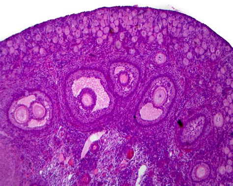 GSC International PS0224 Immature Ovary, Mammalian; Showing Primary ...