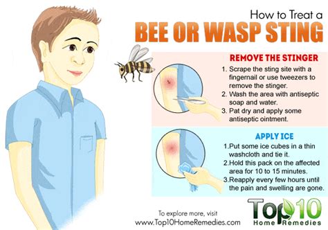 How to Treat a Bee or Wasp Sting | Top 10 Home Remedies