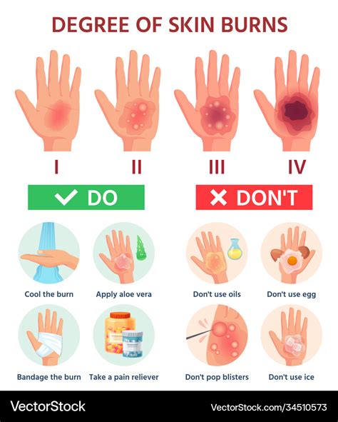 Burns degree first aid for burn wound fire Vector Image