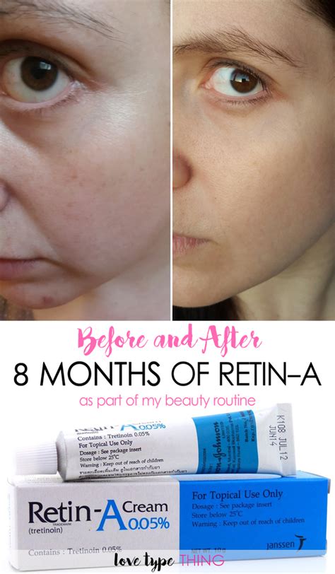 Before and After Retin-A Skin Tips, Skin Care Tips, Tretinoin, Anti ...