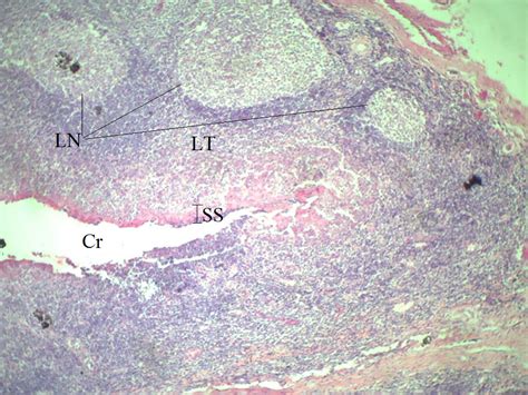 Palatine Tonsil, 4X | Histology