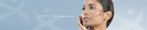 Dermal Filler Side Effects | Preventous Cosmetic Medicine