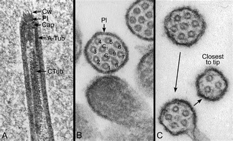 Electron microscopy of efferent ductule cilia. A.Higher magnification ...