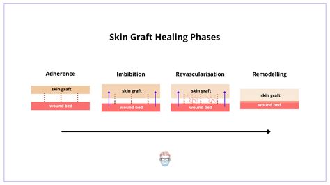 Skin Grafts