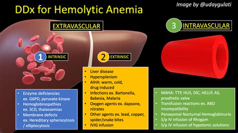 How do you workup hemolytic anemia? – Inspired MedEd