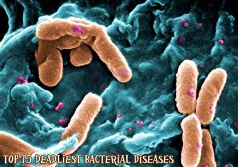 Bacterial Diseases | Top 14 Most Deadliest Diseases Caused By Bacteria