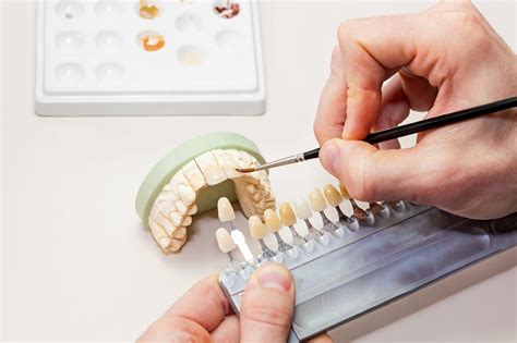 What Is an Aesthetic Dentist? (And How They Can Help You) | Estrabillo ...