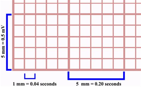 Ekg Graph Paper