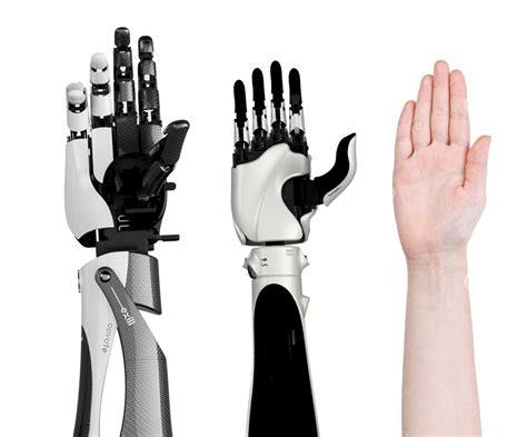 The HACKberry is a 3D printable myoelectric prosthetic arm created by ...