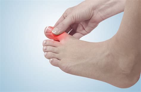 Big Toe Arthritis - The Frankel Foot & Ankle Center