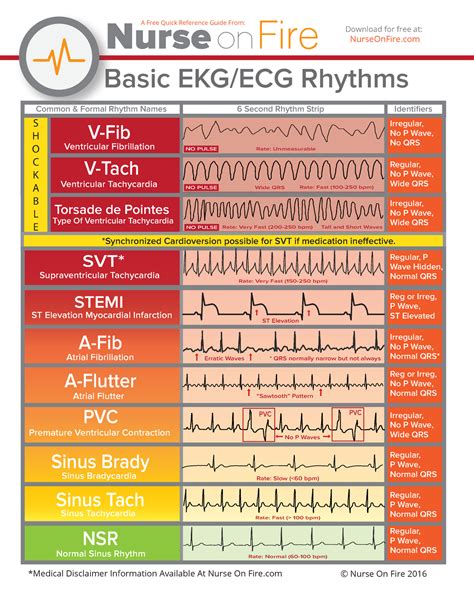 Basic EKG ECG Rhythms Cheatsheet - Basic EKG/ECG Rhythms V-Fib V-Tach ...