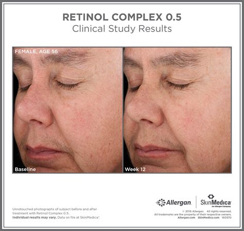 Retinol Complex by SkinMedica® in 0.25%, 0.5%, 1% | Buy Online in Canada