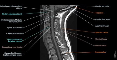 Cervical Spine Mri Normal Anatomy E Anatomy – NBKomputer