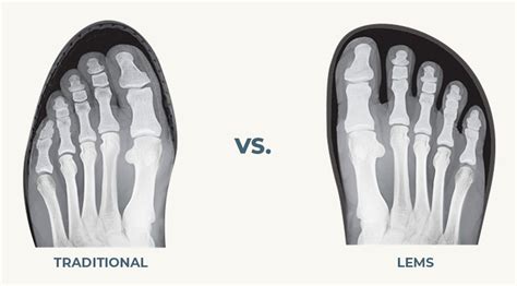 Wide Toe Box Hiking Boots: What's The Benefit? – Lems Shoes