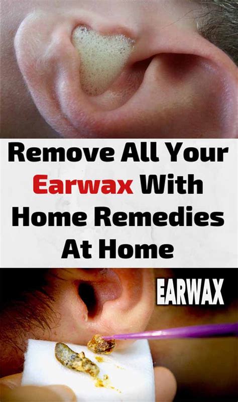 THE RIGHT WAY TO REMOVE THE EAR WAX