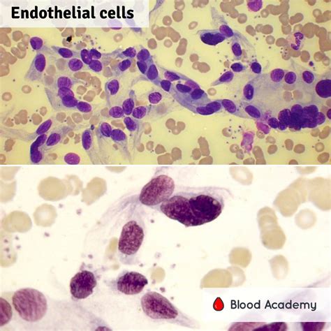 Endothelial cells - Blood Academy