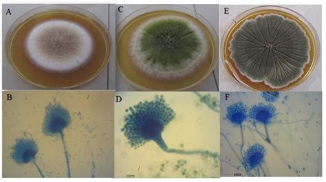 Microscopic image of Aspergillus terreus (A: conidiophore (x40); B ...