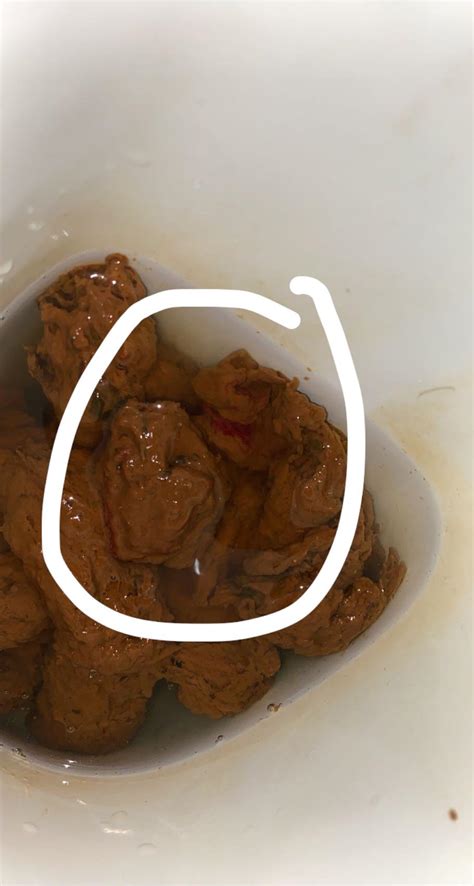 Bright red blood on stool any ideas what could it be? : r/poop