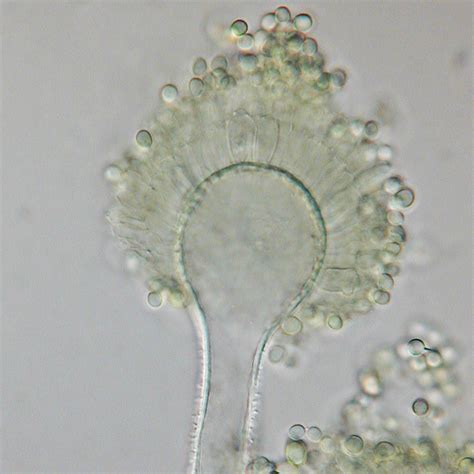 Aspergillus flavus – NutraWiki