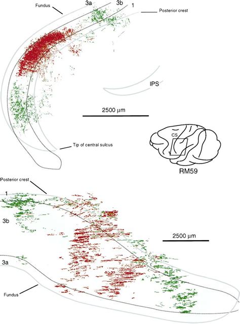 Location of part of postcentral gyrus containing labeled... | Download ...