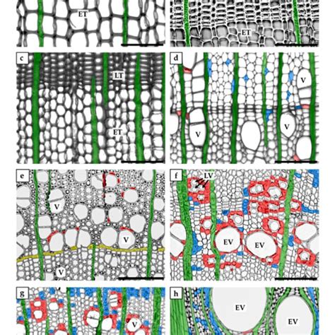 (PDF) Xylem Parenchyma—Role and Relevance in Wood Functioning in Trees