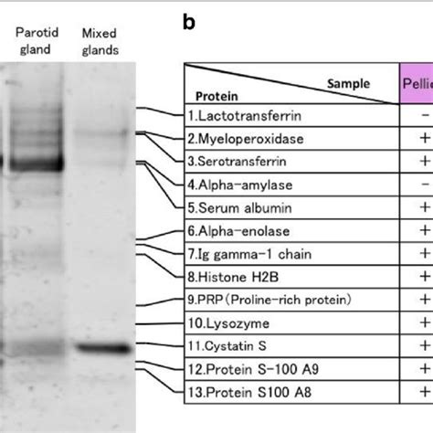 SDS-PAGE and protein identification of each sample. a Samples (5 ...