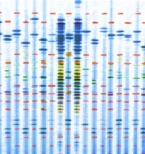 DNA profile - Stock Image - F029/2444 - Science Photo Library