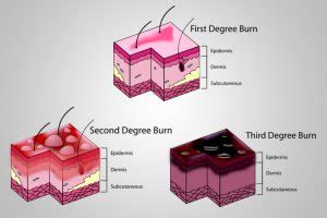 Do Bones Burn? » ScienceABC