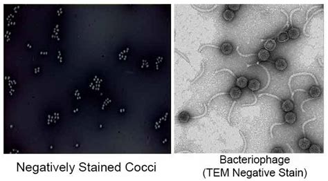 Cell Membrane in Bacteria