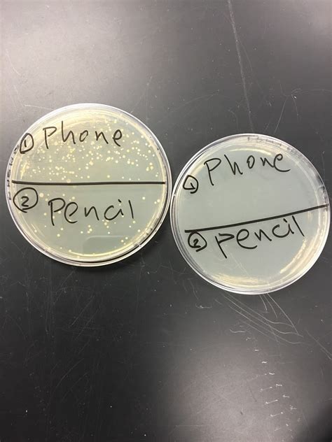 BIOL213 | PLANTS ONE: Mystery TSA Plates