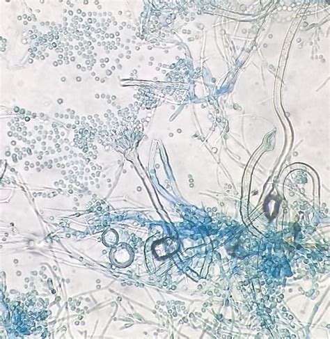 The microscopic morphology of Aspergillus versicolor is very ...