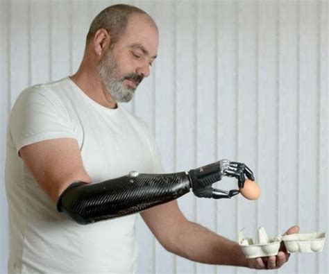 Increíble | Robot arm, Prosthetics, Robotic prosthetics