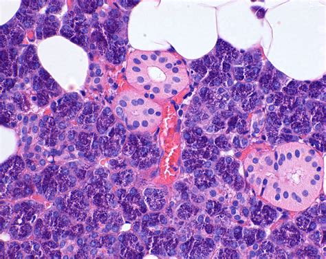 Parotid Histology