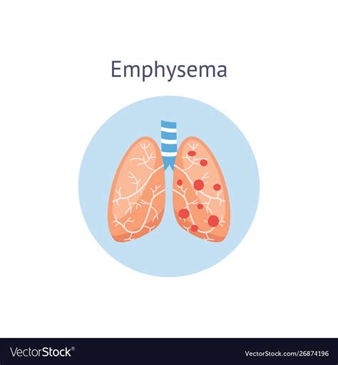 Emphysema Lung Disease Symptoms